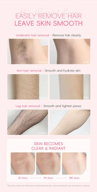 LAIKOU Sakura Hair Removal Cream Fast Painless Hair Growth Inhibitor Arm Armpit Legs Intimate Areas for Men Woman 50g